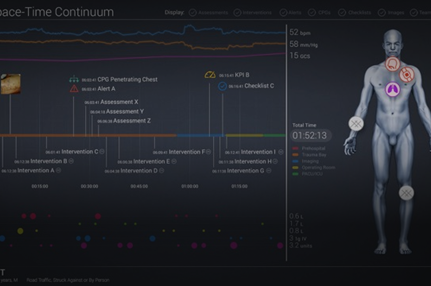 Testing Point of Care Data Collection and Analytics in Trauma Surgery